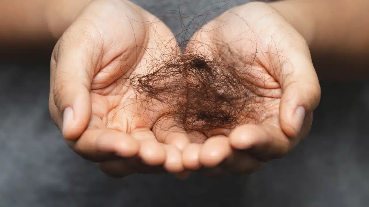 Hair Loss